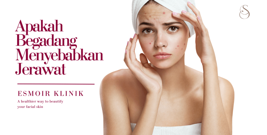 apakah begadang menyebabkan jerawat