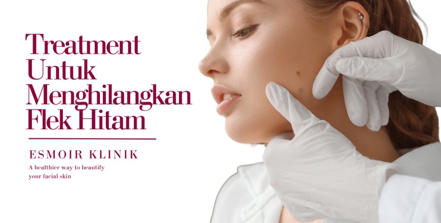 5 Treatment Untuk Menghilangkan Flek Hitam! Nih Kata Dokter!