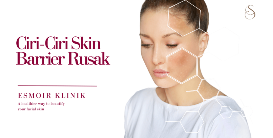 7 Ciri-Ciri Skin Barrier Rusak, Jangan Sampai Terlambat!