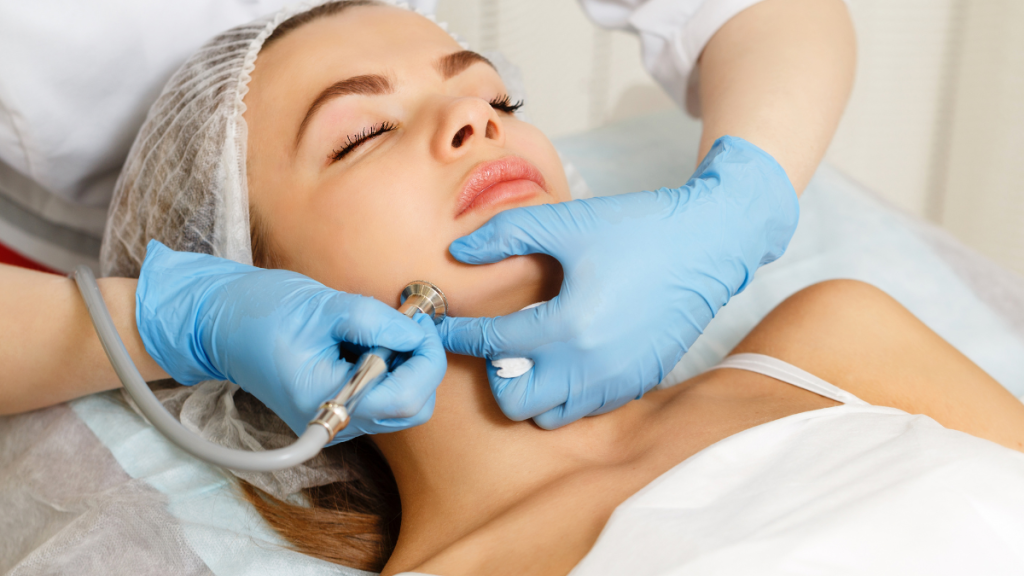 Treatment Mikrodermabrasi