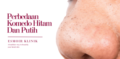 perbedaan komedo hitam dan putih