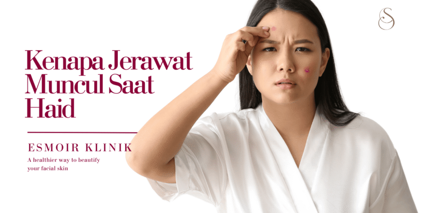 Kenapa jerawat muncul saat haid