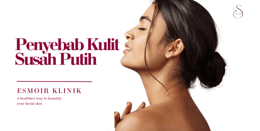 penyebab kulit susah putih