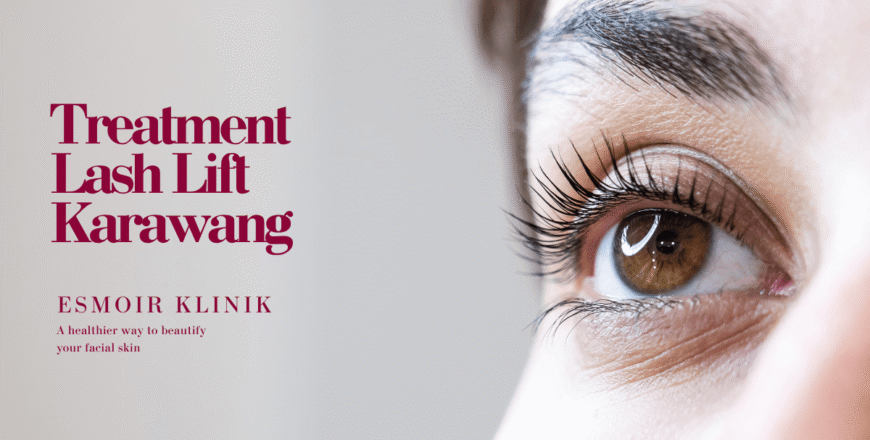 Treatment Lash Lift Karawang
