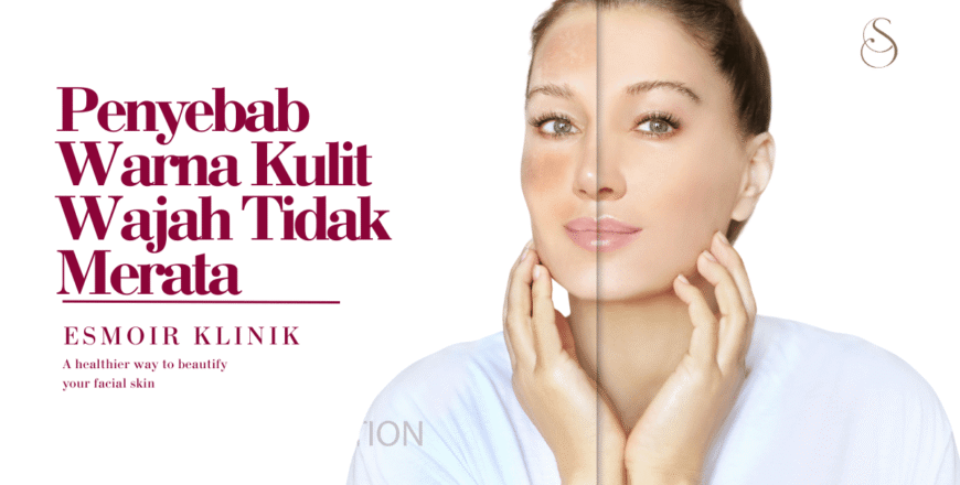 penyebab warna kulit wajah tidak merata