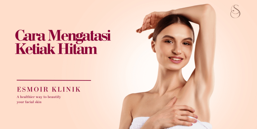 cara mengatasi ketiak hitam